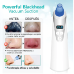 Extractor Quita espinillas Digital Blanc